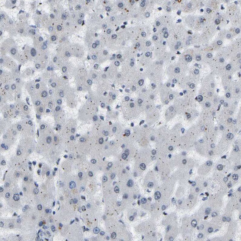 FoxK1 Antibody - BSA Free Immunohistochemistry-Paraffin: FoxK1 Antibody [NBP1-83109]