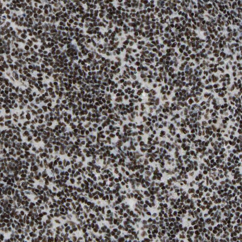 FoxK1 Antibody - BSA Free Immunohistochemistry-Paraffin: FoxK1 Antibody [NBP1-83109]