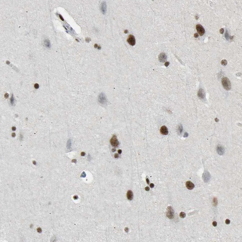 FoxK1 Antibody - BSA Free Immunohistochemistry-Paraffin: FoxK1 Antibody [NBP1-83109]