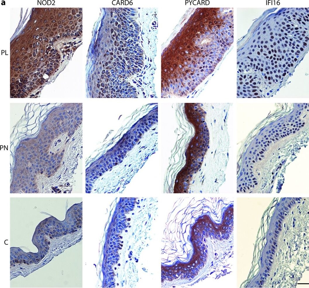 IFI16 Antibody