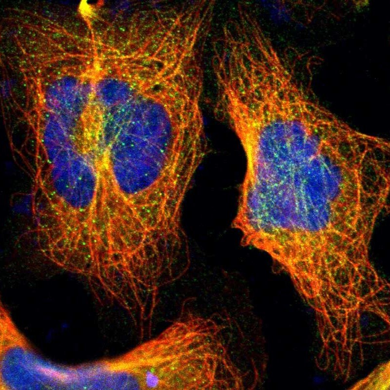 IGBP1 Antibody - BSA Free Immunocytochemistry/ Immunofluorescence: IGBP1 Antibody [NBP1-83126]