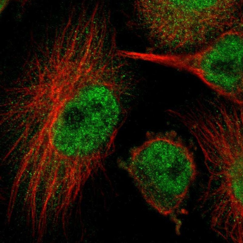 HUWE1 Antibody - BSA Free Immunocytochemistry/ Immunofluorescence: HUWE1 Antibody [NBP1-83127]