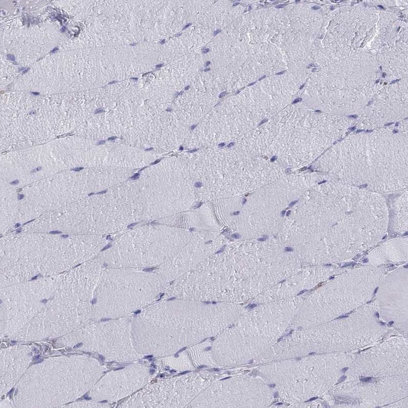IA-2/PTPRN Antibody - BSA Free Immunohistochemistry: IA-2/PTPRN Antibody - BSA Free [NBP1-83128]