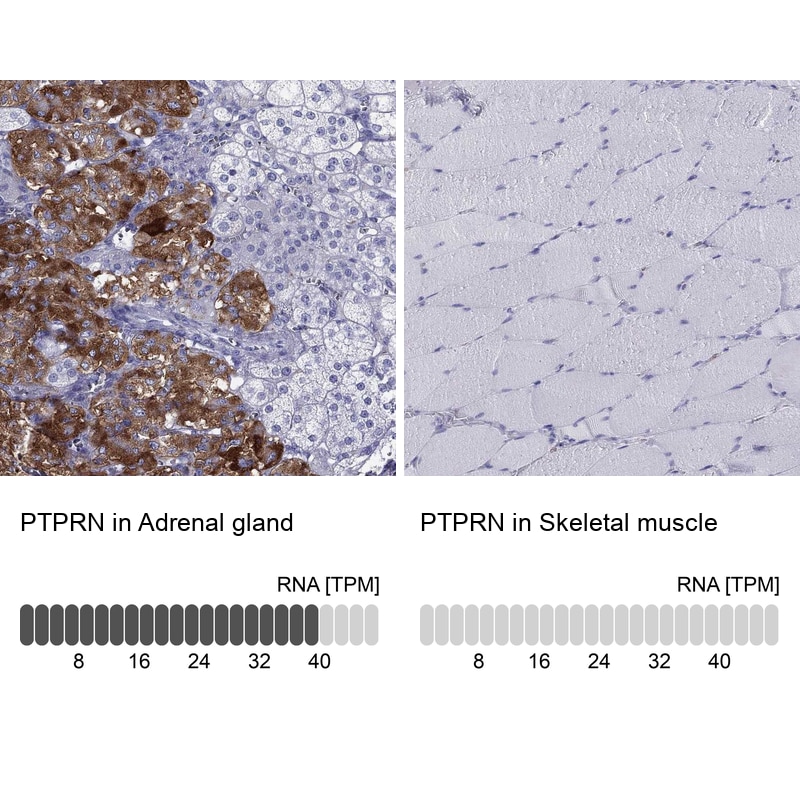 IA-2/PTPRN Antibody - BSA Free Immunohistochemistry: IA-2/PTPRN Antibody - BSA Free [NBP1-83128]