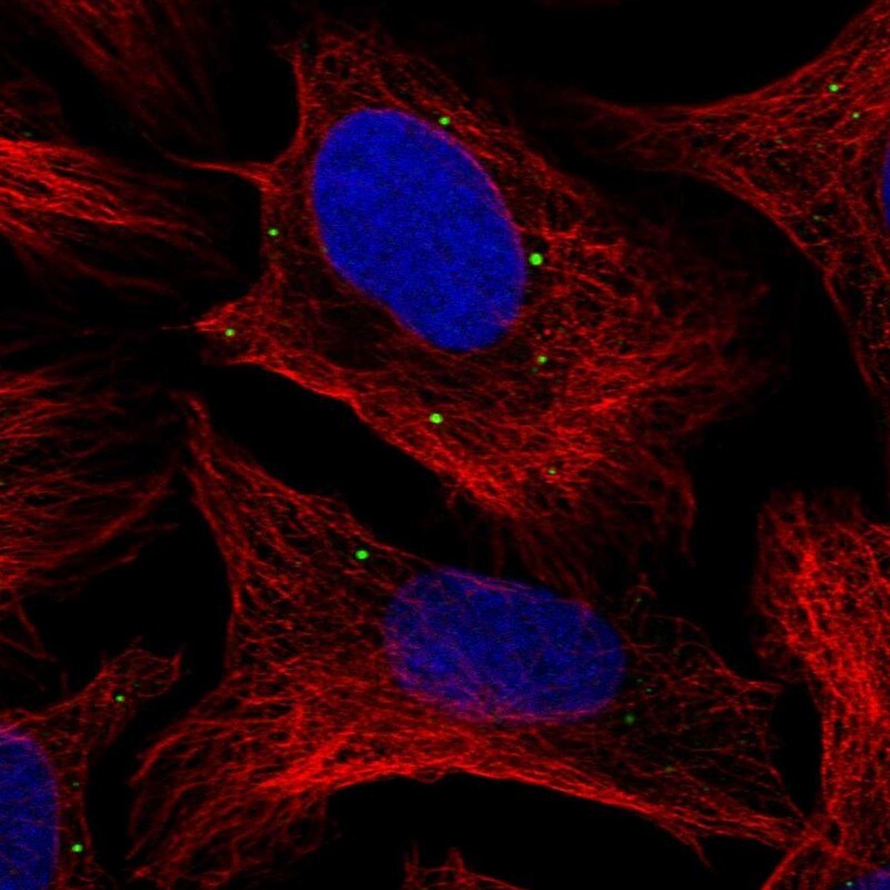 ADP-Sugar Pyrophosphatase/NUDT5 Antibody - BSA Free Immunocytochemistry/ Immunofluorescence: ADP-Sugar Pyrophosphatase/NUDT5 Antibody [NBP1-83131]
