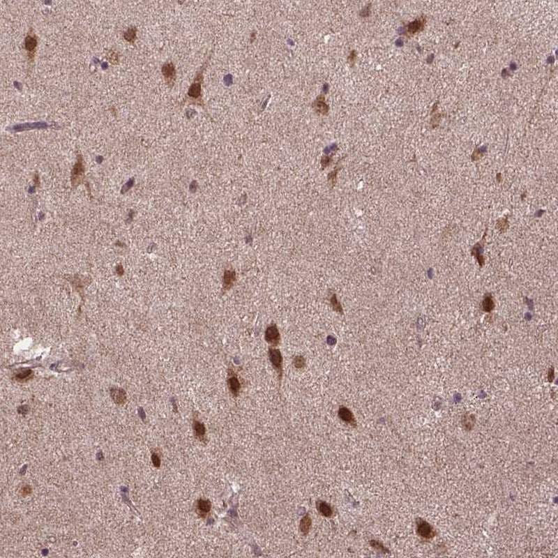 UBA3 Antibody - BSA Free Immunohistochemistry: UBA3 Antibody - BSA Free [NBP1-83150]