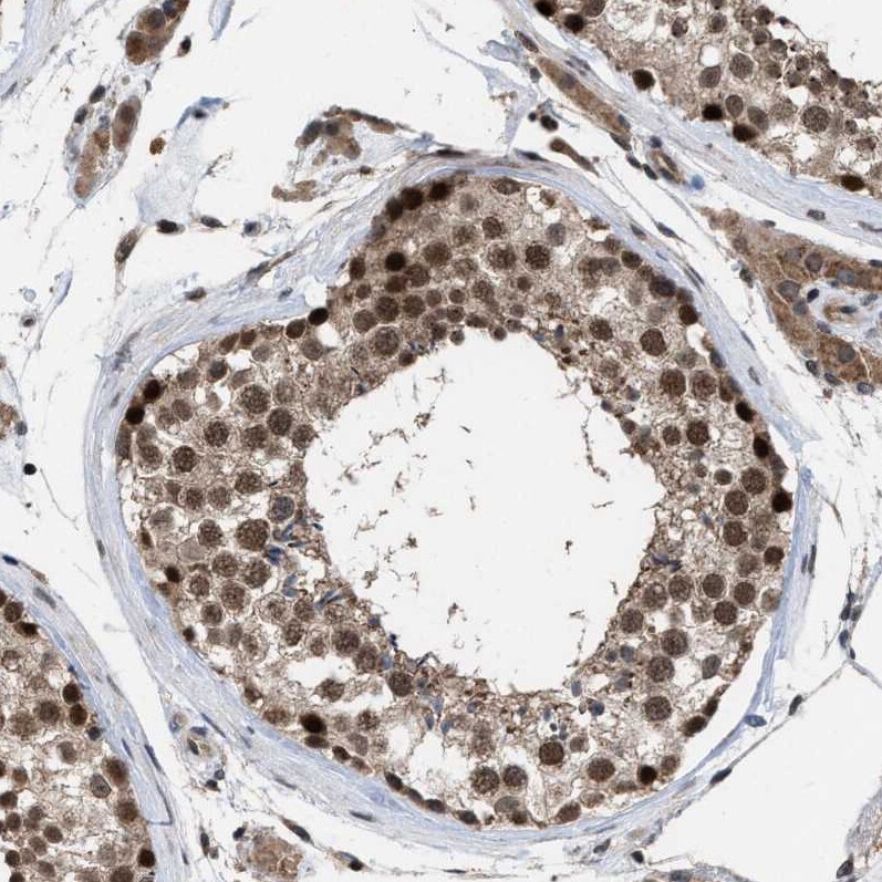 HCA59 Antibody - BSA Free Immunohistochemistry-Paraffin: HCA59 Antibody [NBP1-83170]