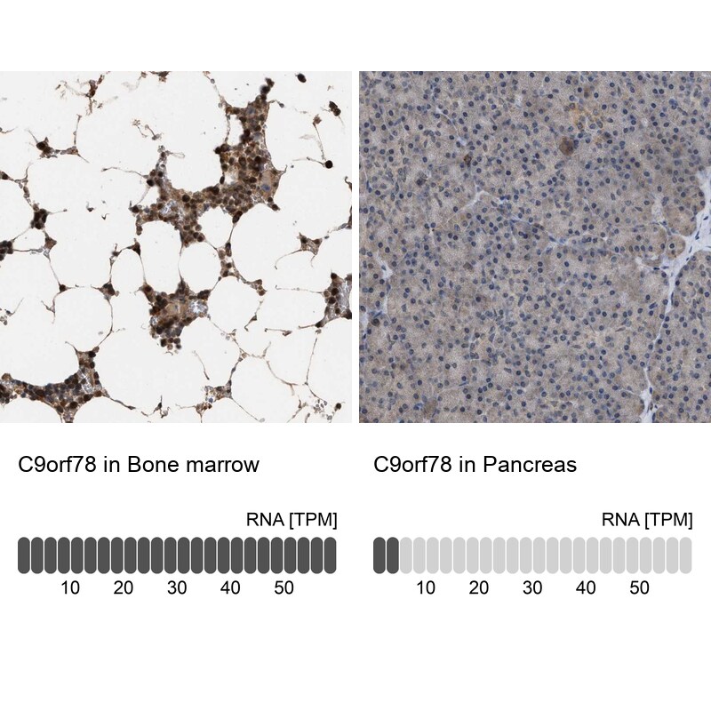 HCA59 Antibody - BSA Free Immunohistochemistry-Paraffin: HCA59 Antibody [NBP1-83170]