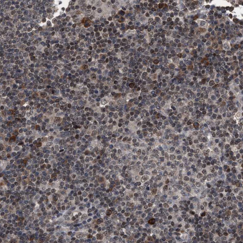 HCA59 Antibody - BSA Free Immunohistochemistry-Paraffin: HCA59 Antibody [NBP1-83170]