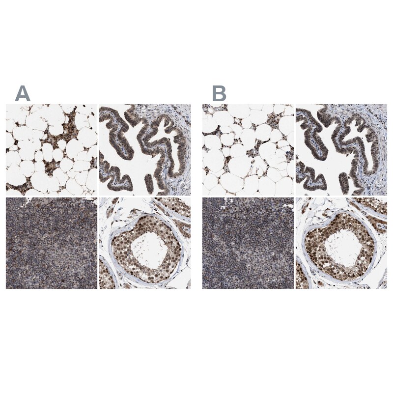 HCA59 Antibody - BSA Free Immunohistochemistry-Paraffin: HCA59 Antibody [NBP1-83170]