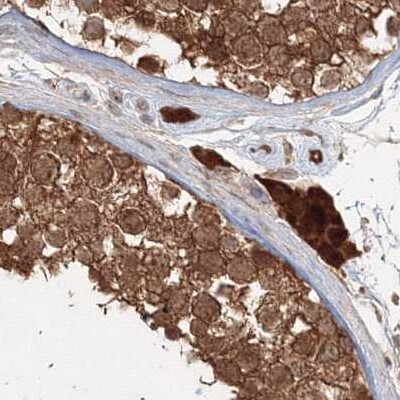 MKRN2 Antibody - BSA Free Immunohistochemistry-Paraffin: MKRN2 Antibody [NBP1-83178]