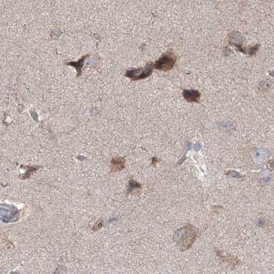 MKRN2 Antibody - BSA Free Immunohistochemistry-Paraffin: MKRN2 Antibody [NBP1-83178]