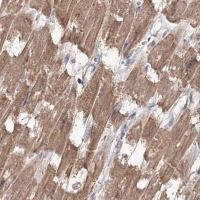 MKRN2 Antibody - BSA Free Immunohistochemistry-Paraffin: MKRN2 Antibody [NBP1-83178]