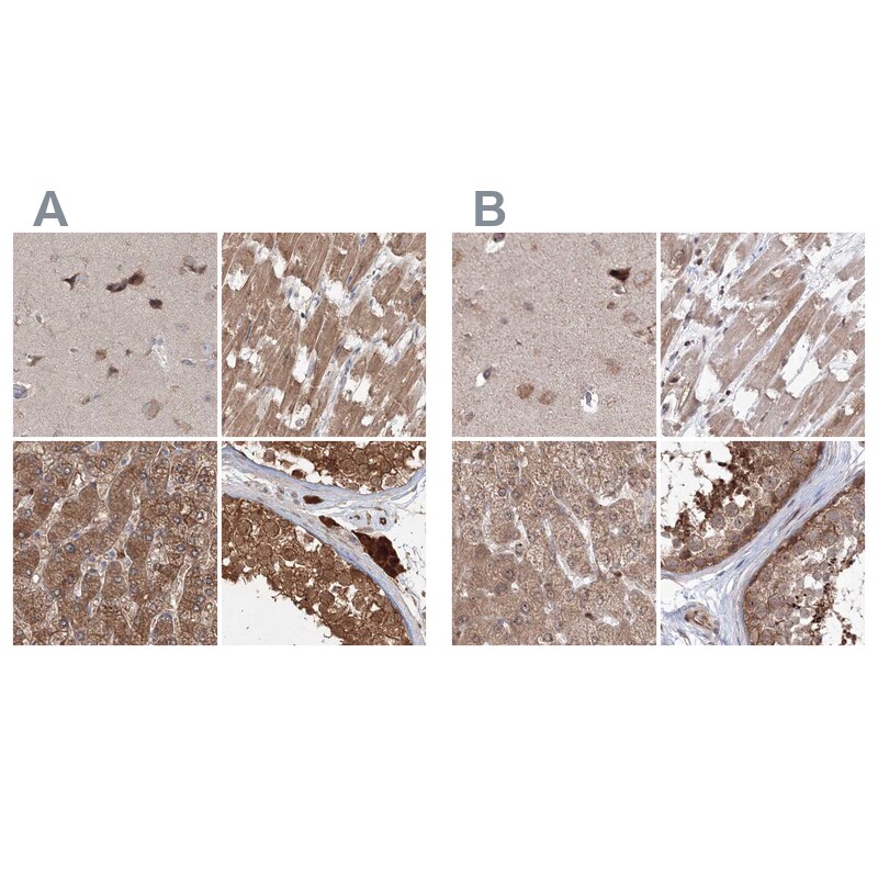 MKRN2 Antibody - BSA Free Immunohistochemistry-Paraffin: MKRN2 Antibody [NBP1-83178]