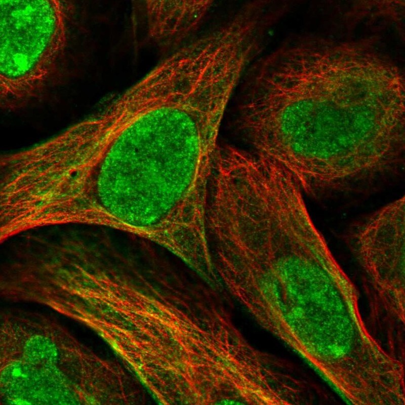ORC1 Antibody - BSA Free Immunocytochemistry/ Immunofluorescence: ORC1 Antibody [NBP1-83184]