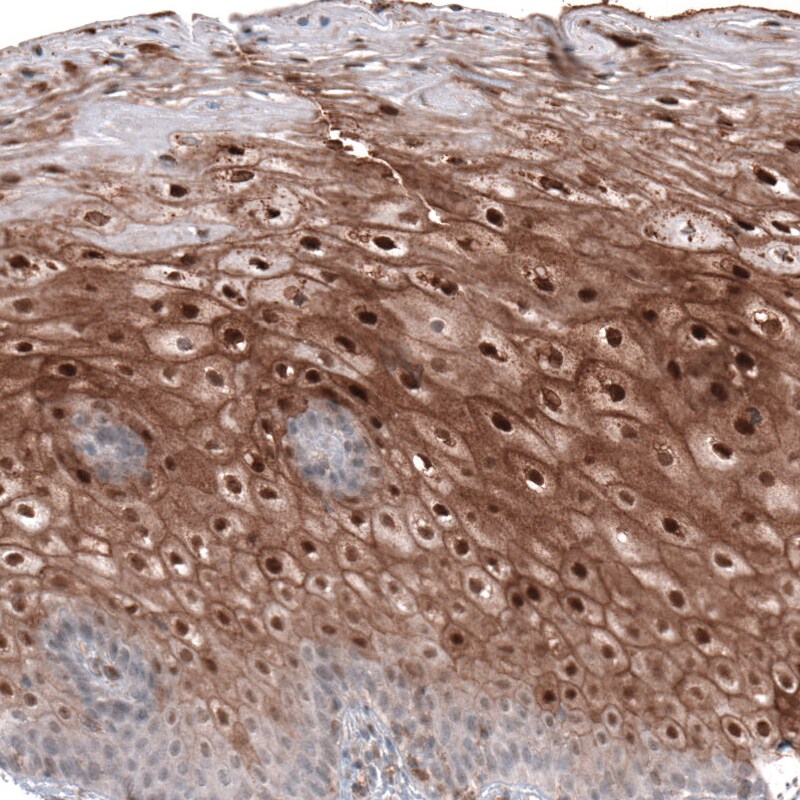 SMYD2 Antibody - BSA Free Immunohistochemistry-Paraffin: SMYD2 Antibody [NBP1-83186]