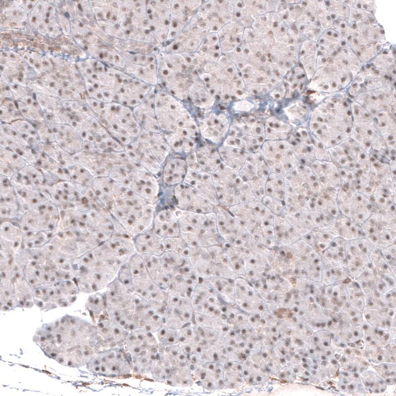 SMYD2 Antibody - BSA Free Immunohistochemistry-Paraffin: SMYD2 Antibody [NBP1-83186]