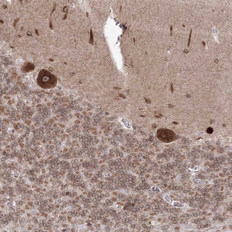 DNAJB2 Antibody - BSA Free Immunohistochemistry-Paraffin: DNAJB2 Antibody [NBP1-83188]