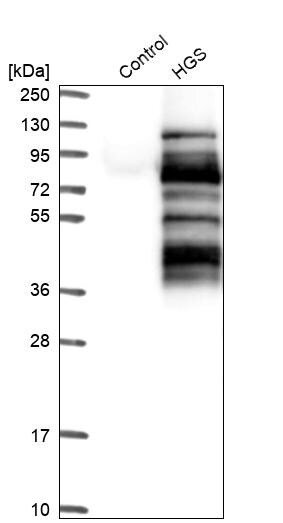 HGS Antibody - BSA Free Western Blot: HGS Antibody - BSA Free [NBP1-83202]