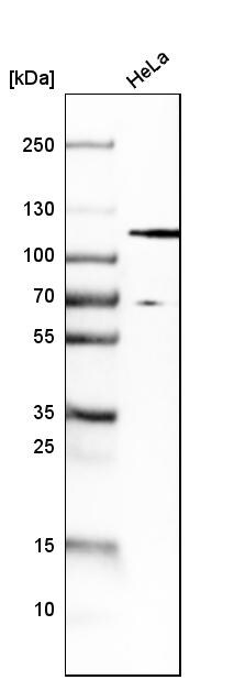 HGS Antibody - BSA Free Western Blot: HGS Antibody - BSA Free [NBP1-83203]