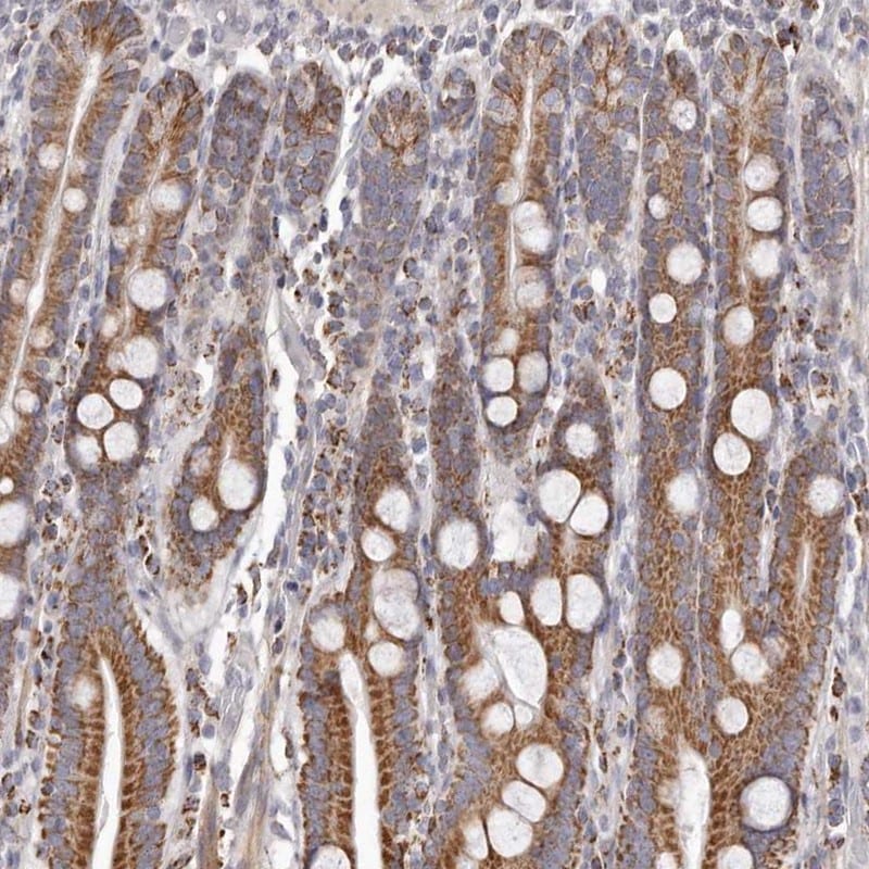 PRMT2 Antibody - BSA Free Immunohistochemistry-Paraffin: PRMT2 Antibody [NBP1-83207]