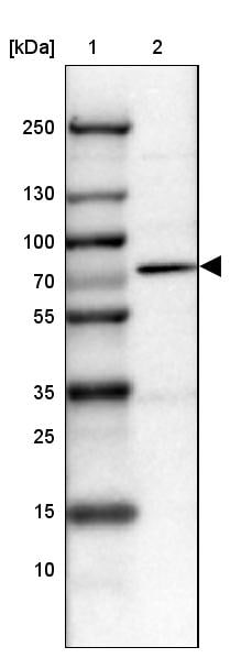 PRMT2 Antibody - BSA Free Western Blot: PRMT2 Antibody - BSA Free [NBP1-83207]