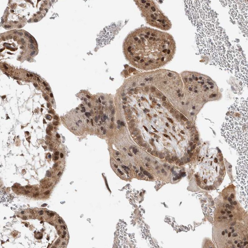 ZNF318 Antibody - BSA Free Immunohistochemistry-Paraffin: ZNF318 Antibody - BSA Free [NBP1-83208]