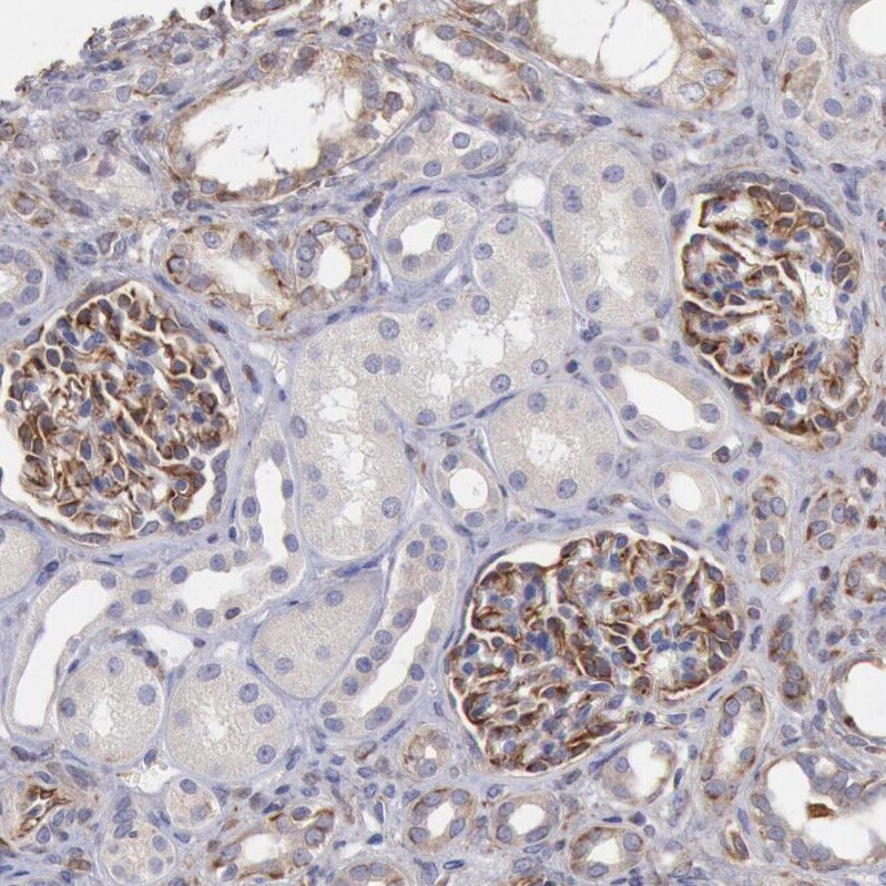 RNF139 Antibody - BSA Free Immunohistochemistry-Paraffin: RNF139 Antibody - BSA Free [NBP1-83212]