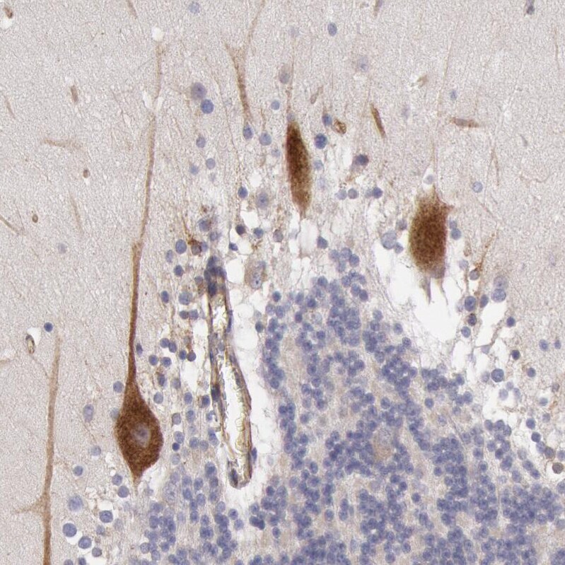 RNF139 Antibody - BSA Free Immunohistochemistry-Paraffin: RNF139 Antibody - BSA Free [NBP1-83212]