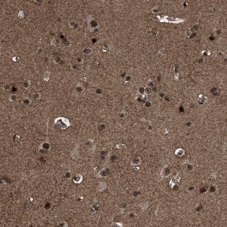 PRPF4 Antibody - BSA Free Immunohistochemistry-Paraffin: PRPF4 Antibody - BSA Free [NBP1-83218]