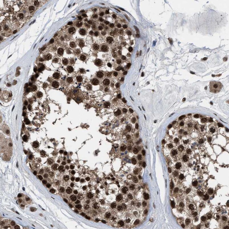 PRPF4 Antibody - BSA Free Immunohistochemistry-Paraffin: PRPF4 Antibody - BSA Free [NBP1-83218]
