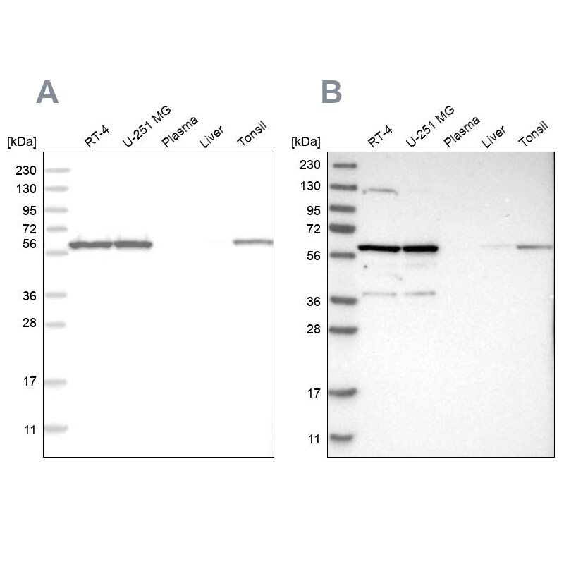 PRPF4 Antibody - BSA Free Western Blot: PRPF4 Antibody - BSA Free [NBP1-83218]