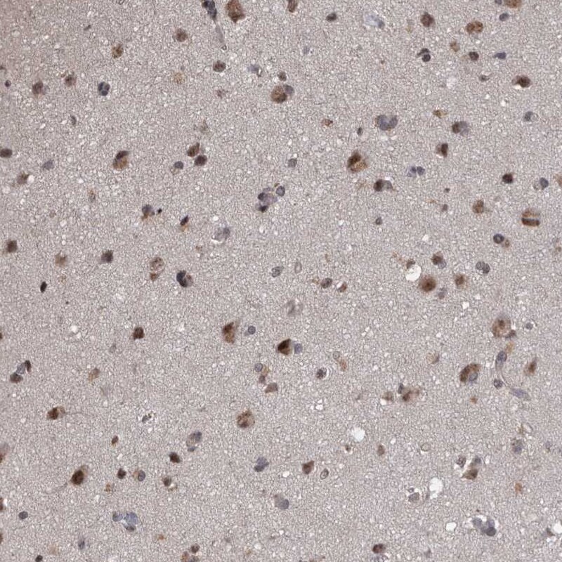 PRPF3 Antibody - BSA Free Immunohistochemistry-Paraffin: PRPF3 Antibody - BSA Free [NBP1-83219]