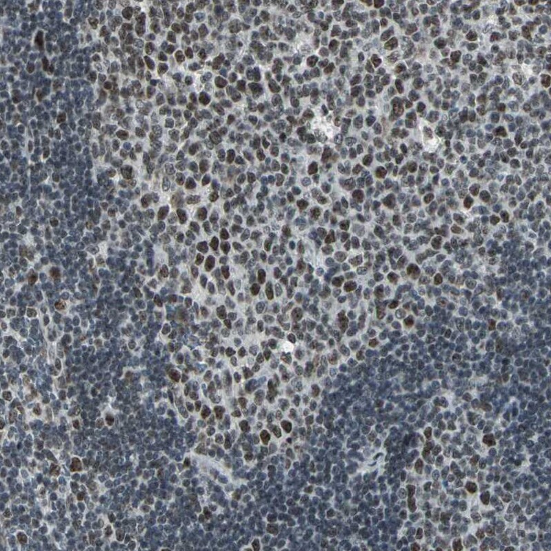 CBX3 Antibody - BSA Free Immunohistochemistry-Paraffin: CBX3 Antibody - BSA Free [NBP1-83228]