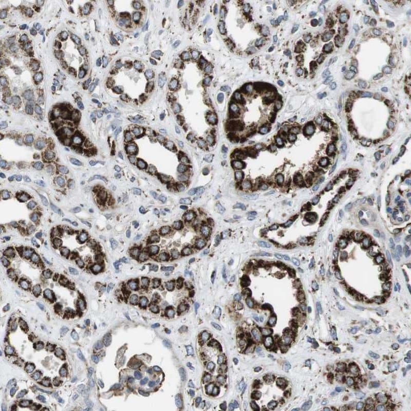 MiRP2 Antibody - BSA Free Immunohistochemistry: MiRP2 Antibody - BSA Free [NBP1-83238]