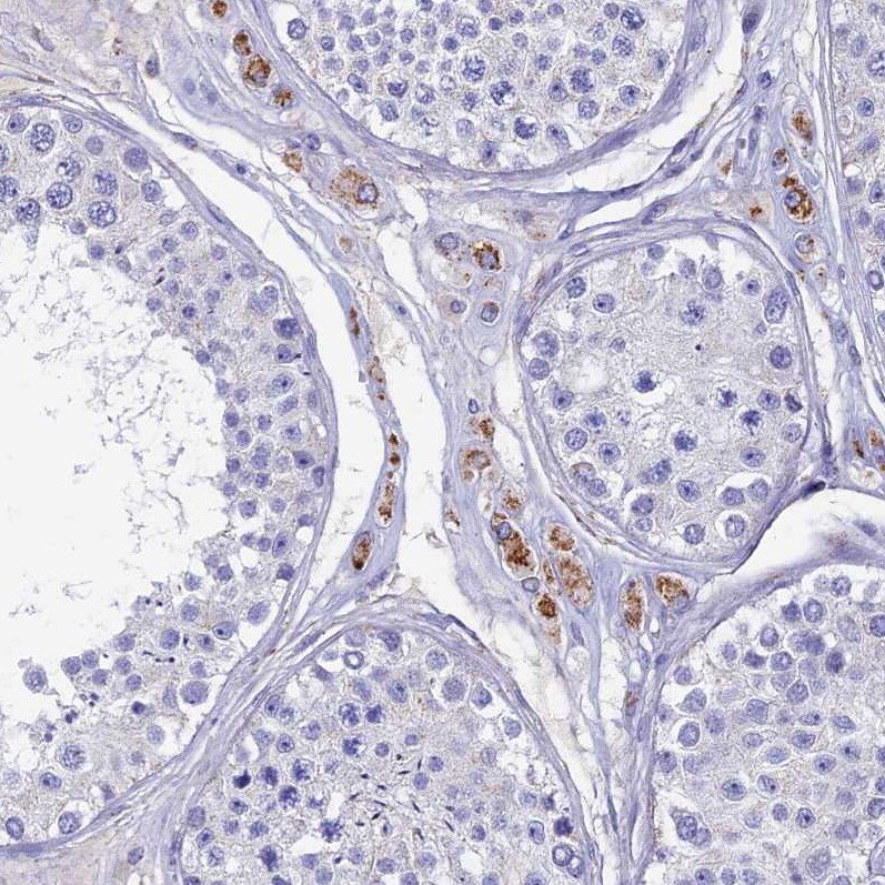 OAT Antibody - BSA Free Immunohistochemistry-Paraffin: OAT Antibody [NBP1-83239]