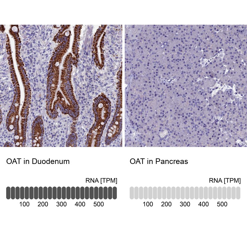 OAT Antibody - BSA Free Immunohistochemistry-Paraffin: OAT Antibody [NBP1-83239]