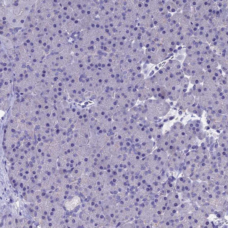 OAT Antibody - BSA Free Immunohistochemistry-Paraffin: OAT Antibody [NBP1-83239]