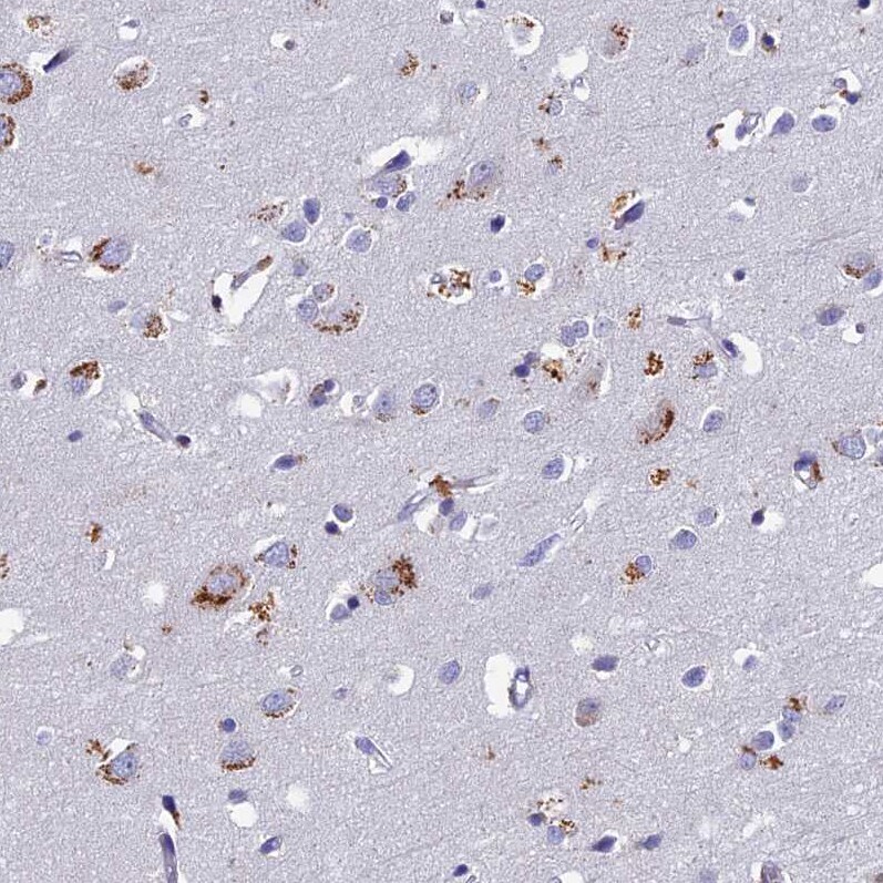 OAT Antibody - BSA Free Immunohistochemistry-Paraffin: OAT Antibody [NBP1-83239]