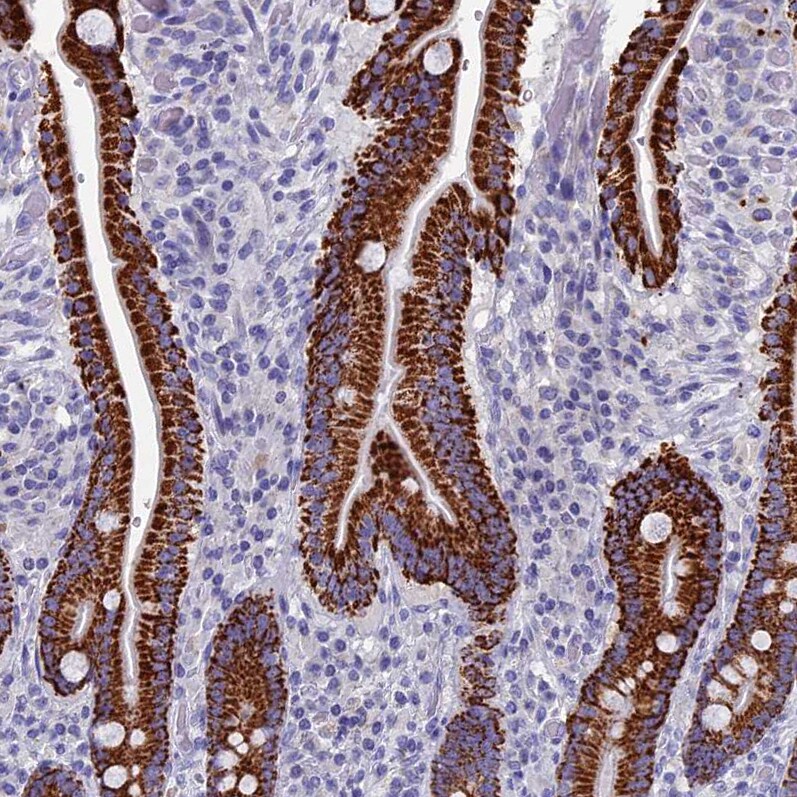 OAT Antibody - BSA Free Immunohistochemistry-Paraffin: OAT Antibody [NBP1-83239]