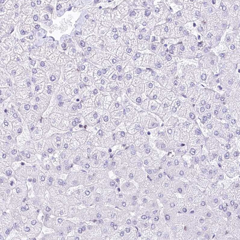 HNRNPA0 Antibody Immunohistochemistry-Paraffin: HNRNPA0 Antibody [NBP1-83240]