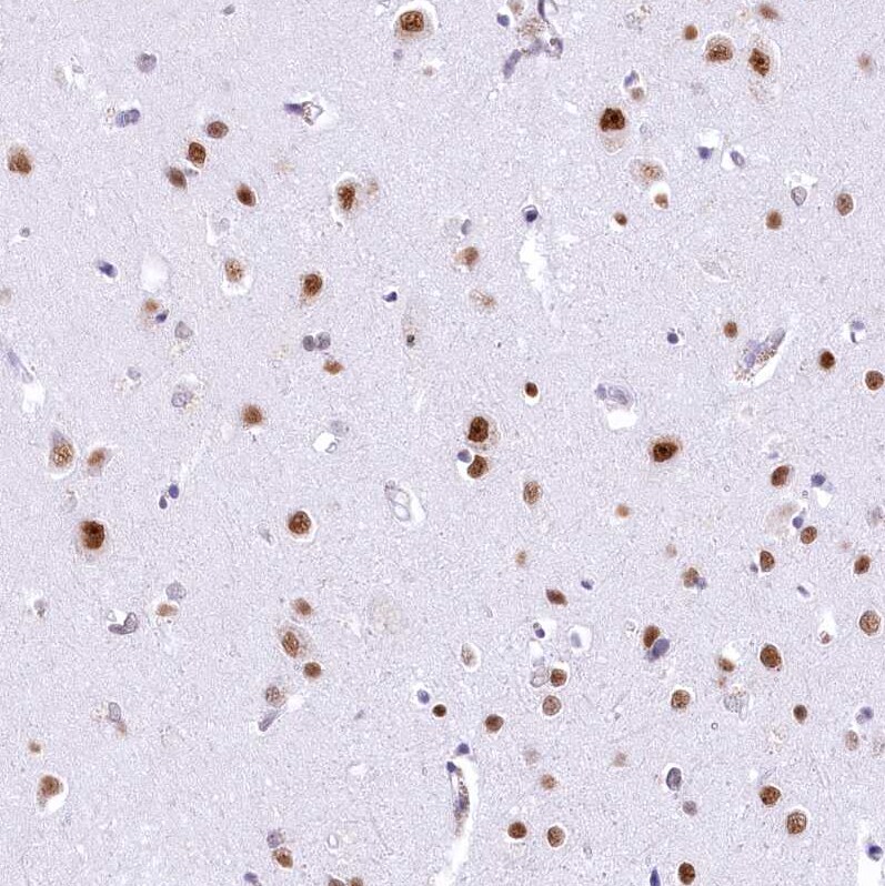 HNRNPA0 Antibody Immunohistochemistry-Paraffin: HNRNPA0 Antibody [NBP1-83240]