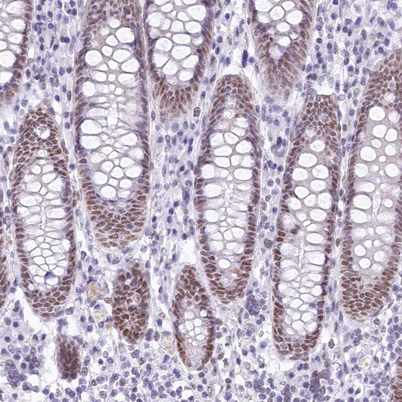 HNRNPA0 Antibody Immunohistochemistry-Paraffin: HNRNPA0 Antibody [NBP1-83240]