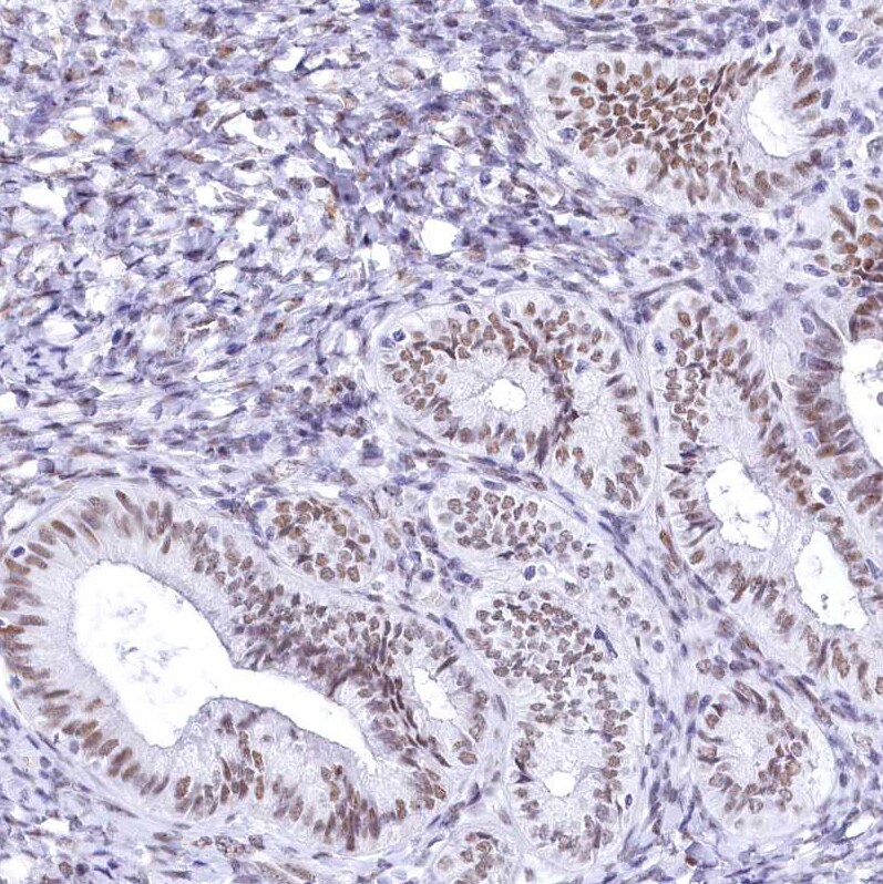 HNRNPA0 Antibody Immunohistochemistry-Paraffin: HNRNPA0 Antibody [NBP1-83240]