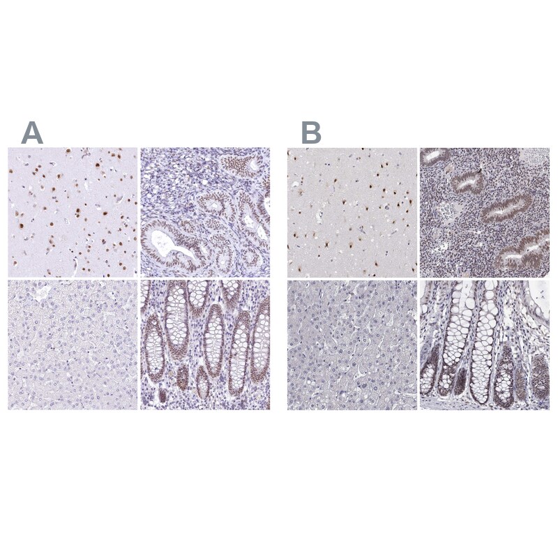 HNRNPA0 Antibody Immunohistochemistry-Paraffin: HNRNPA0 Antibody [NBP1-83240]