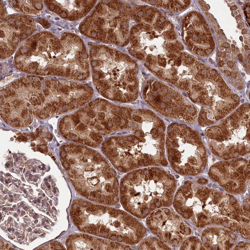 PCBP2 Antibody - BSA Free Immunohistochemistry-Paraffin: PCBP2 Antibody - BSA Free [NBP1-83241]