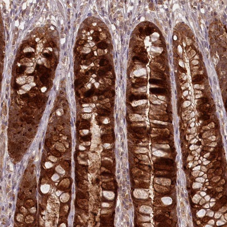 PCBP2 Antibody - BSA Free Immunohistochemistry-Paraffin: PCBP2 Antibody - BSA Free [NBP1-83241]