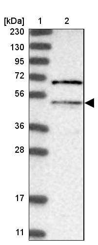 MLYCD Antibody - BSA Free Western Blot: MLYCD Antibody - BSA Free [NBP1-83247]