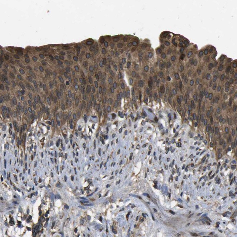 HFE Antibody - BSA Free Immunohistochemistry-Paraffin: HFE Antibody - BSA Free [NBP1-83250]