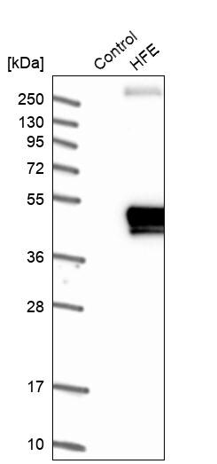 HFE Antibody - BSA Free Western Blot: HFE Antibody - BSA Free [NBP1-83250]